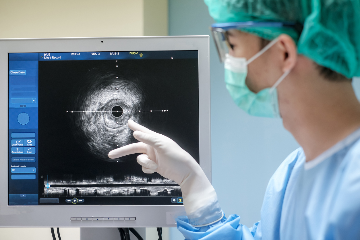 Case Study: Developing a Custom PSU for a High-End Ultrasound System